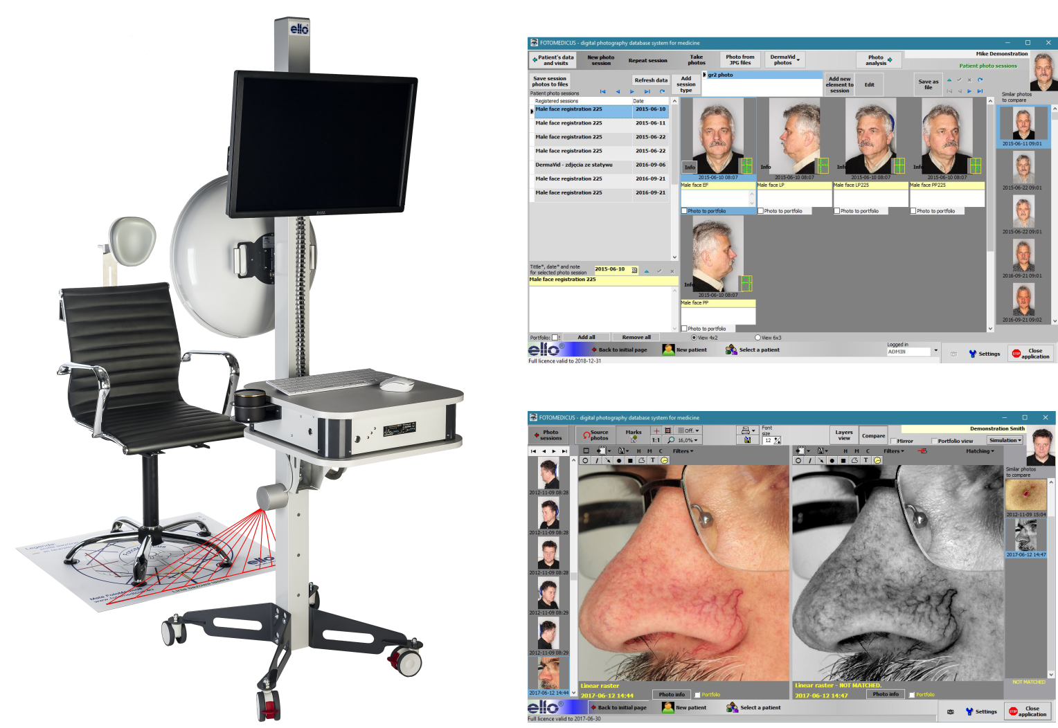 Fotomedicus Professioneel systeem voor Medische Fotografie